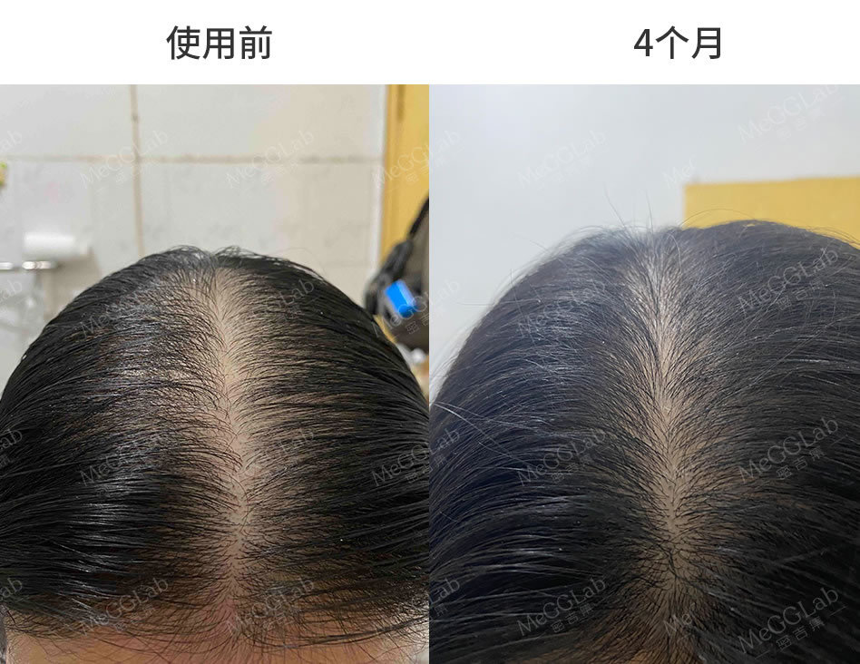 米諾增效_效果圖7 米諾增效_效果圖7