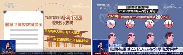 國內脱髮人羣比例