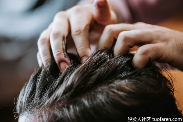 如何治療髮蠟引起的脱髮 如何治療髮蠟引起的脱髮