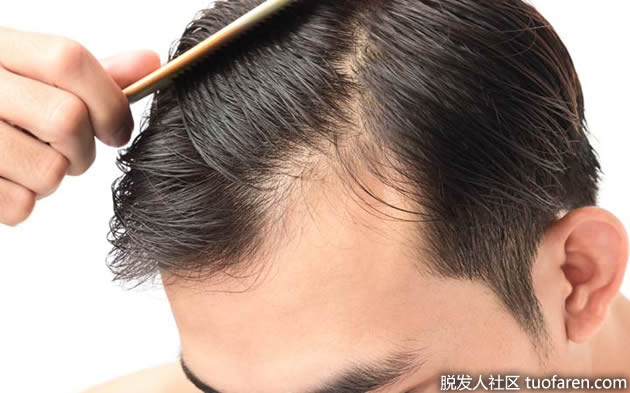 吸煙是如何導致脱髮的?