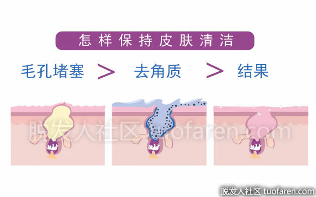 怎樣清潔皮膚 怎樣清潔皮膚