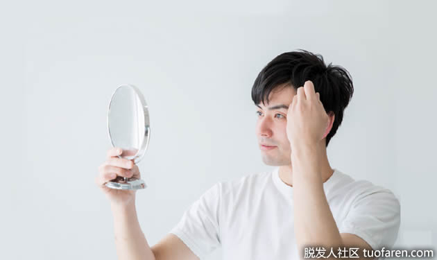 需要植髮的年輕人有哪些特徵?