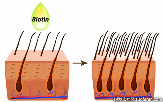 維生素治療脱髮毛髮生物素皮脂溢出 維生素治療脱髮毛髮生物素皮脂溢出