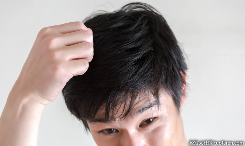 血液循環不良脱髮 血液循環不良脱髮