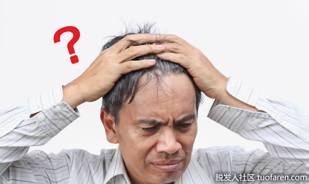 頭頂會脱髮 頭頂會脱髮