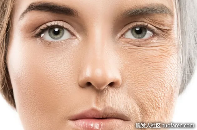 皮膚衰老