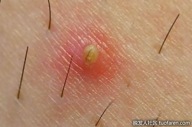 1657513424413052270.jpg 2.jpg