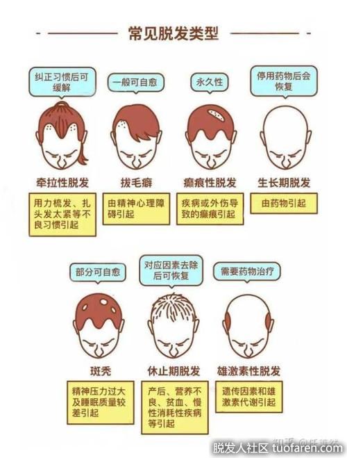 脱髮類型、脱髮等級對照圖8