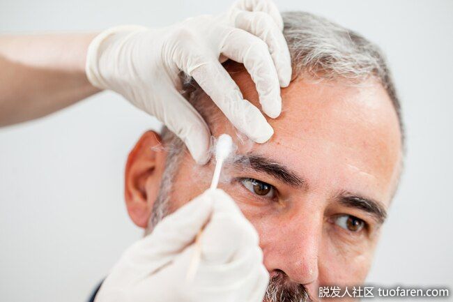 冷凍療法：醫生會把液氮放在你的皮膚上幾秒鐘。這將凍結斑點所在的區域。隨着皮膚的癒合，它會變得更輕。這種治療可能會很痛苦，可能會引起刺激、腫脹、水泡或發紅。也有可能造成疤痕或深色斑點。