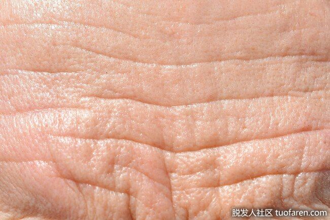 幫助撫平皺紋：維生素C是許多抗衰老產品中的有效成分。一些研究表明，使用至少12周後，它可以減少皺紋的出現。富含這種營養的健康飲食也會有幫助。研究表明，吃更多維生素C的人皺紋更少。它不僅限於柑橘類水果。花椰菜、紅辣椒和菠菜中也含有大量西蘭花。
