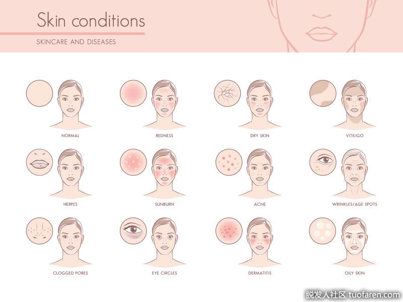 治療皮膚疾病。甘菊茶提取物具有抗氧化的特性，能吸收脂肪酸，為皮膚提供營養。它還提供長時間的水合作用。它也被用於許多其他皮膚治療。