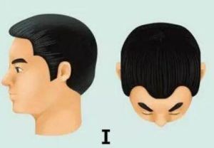 脱髮等級對照圖