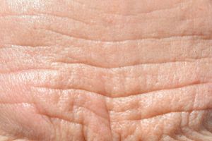 維生素C對皮膚的好處