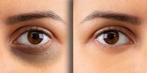 洋甘菊茶的10大作用