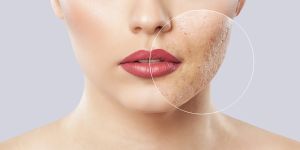 洋甘菊茶的10大作用