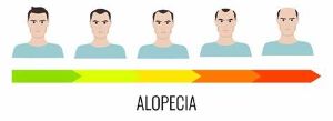 脱髮階段圖