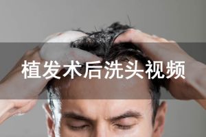 植髮術後洗頭視頻